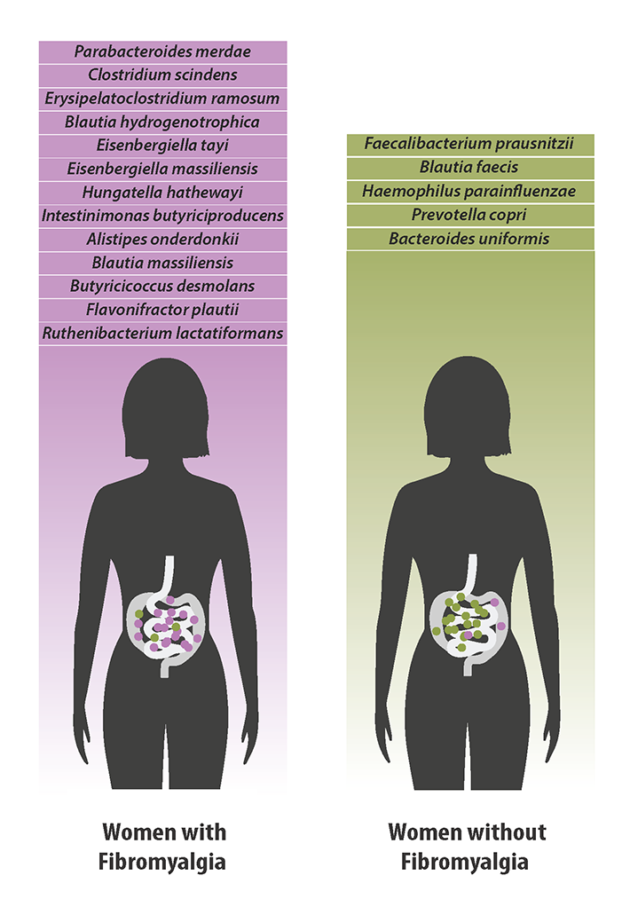 Les différents types de bactéries trouvées en grande quantité dans l’intestin chez les femmes atteintes de fibromyalgie (à gauche) par rapport aux types de bactéries trouvées en plus grande quantité chez des femmes n’ayant pas de fibromyalgie.