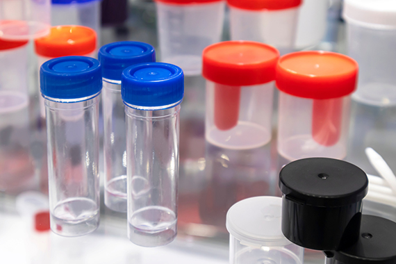 Des labos plus écolos : réutiliser au lieu de jeter des instruments de plastique