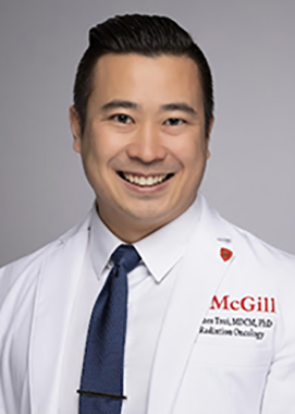 Un essai clinique pour alléger le traitement pour le cancer de la prostate