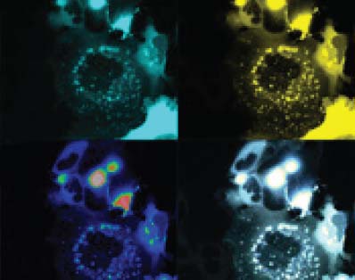 Fluorescence émise par un biocapteur dans les cellules embryonnaires du rein chez l’humain (image de microscopie confoncale).