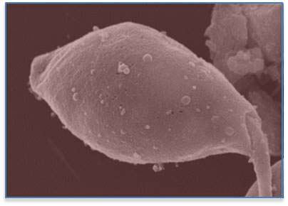 Le parasite Leishmania avec des vésicules (ou exosomes) à sa surface
