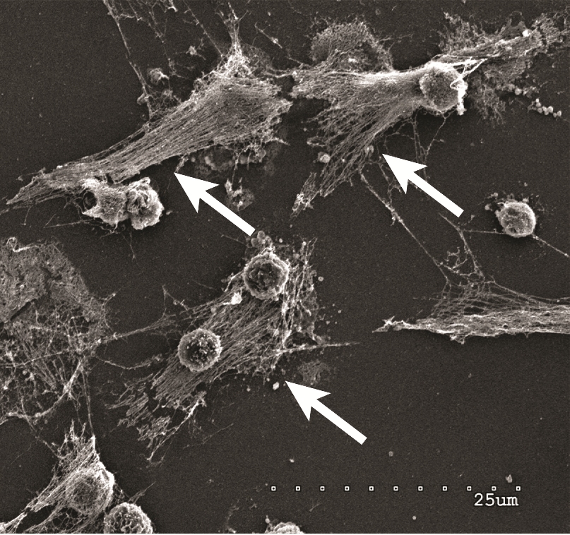 Les neutrophiles, qui font partie du système immunitaire de l'organisme, détectent les bactéries et peuvent expulser leur ADN (voir les fleches) pour les attaquer à l'aide d'un réseau d'ADN attaché à des enzymes toxiques, appelé NET.