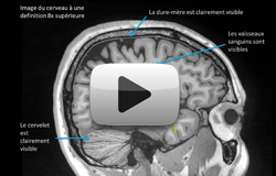 Ultra-High Resoution MRI